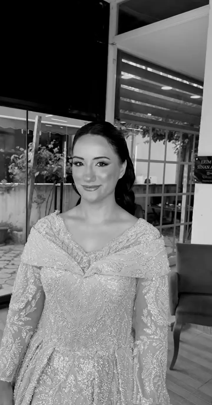 Mikro kaynak sonrası doğal saç görünümü